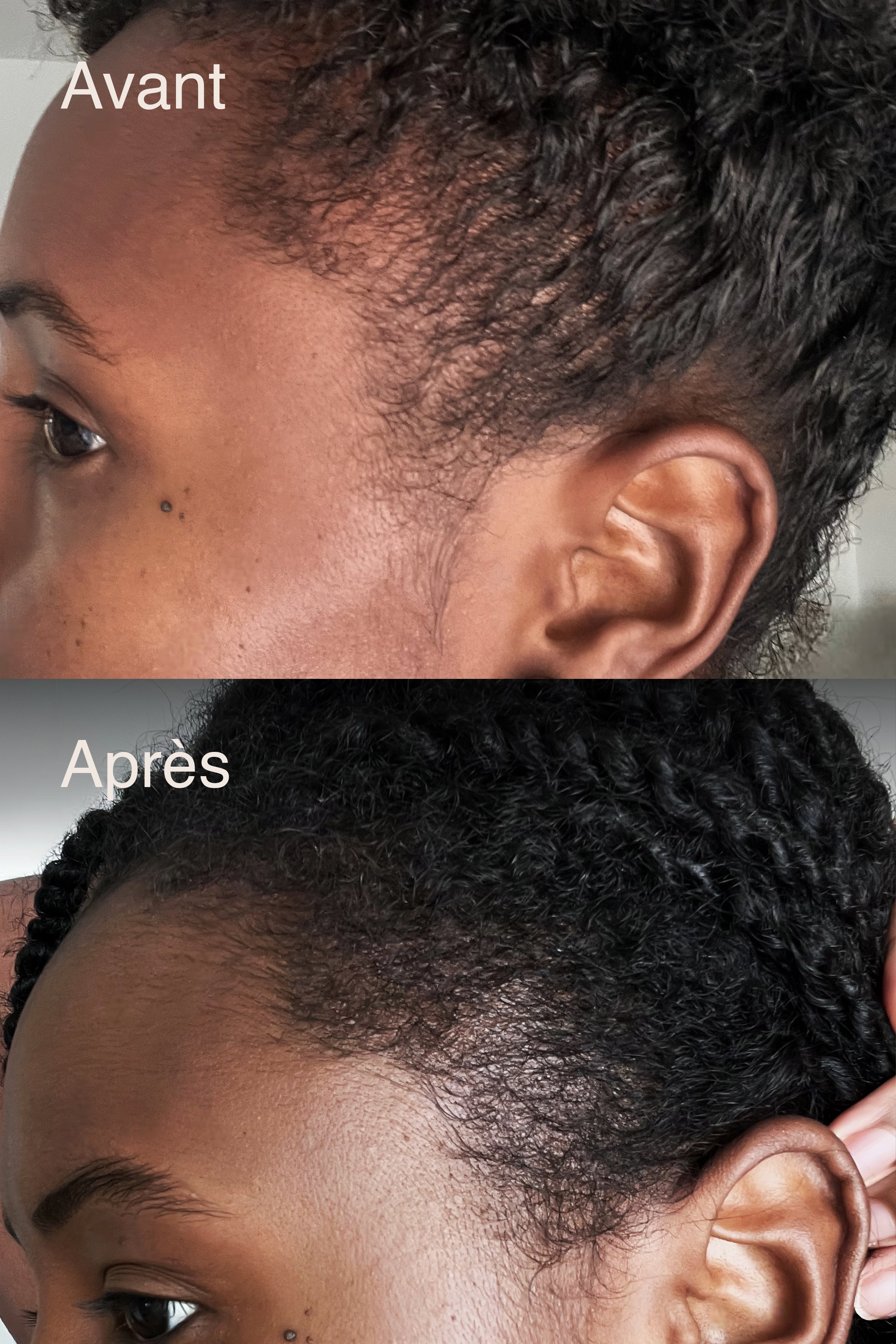 Stick Capillaire – Tempes & zones ciblées - MIRANBELLA